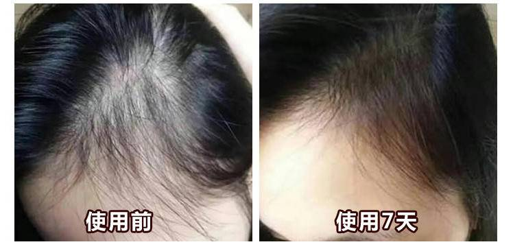 1763358267421838.png 4350b9d7-dcf4-4a74-84d5-5a195fe52fe1.png